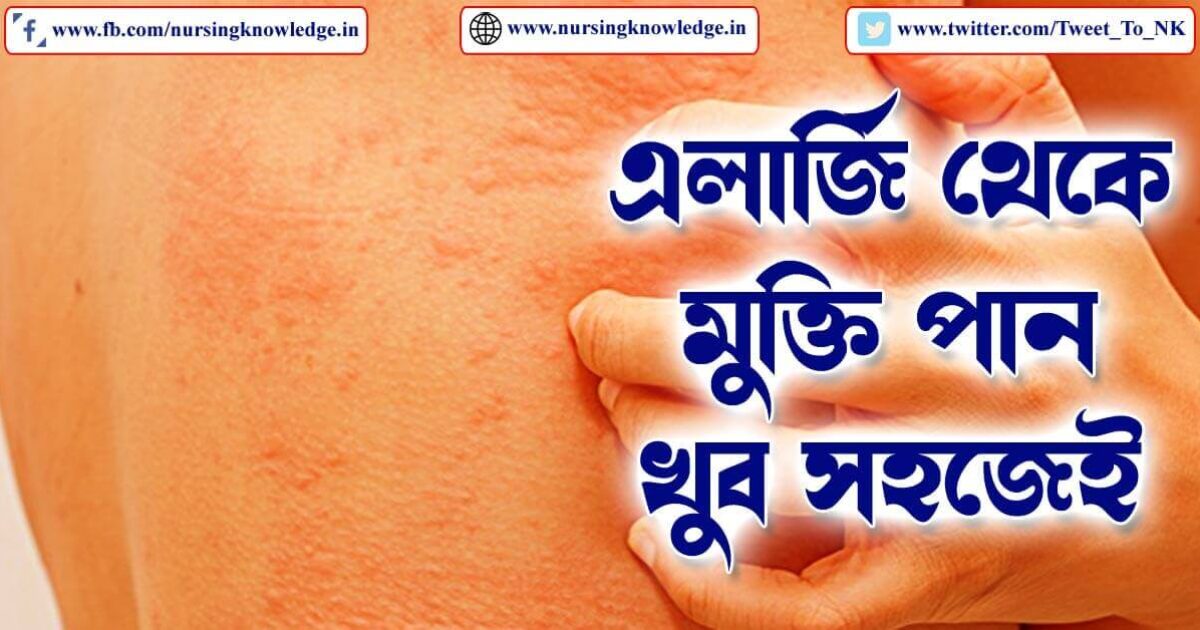 ALLERGY (এলার্জি) DETAILS IN BENGALI WITH HOME REMEDIES