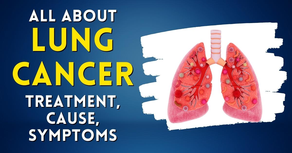 Top 5 Lung Cancer Treatment Latest And Advanced