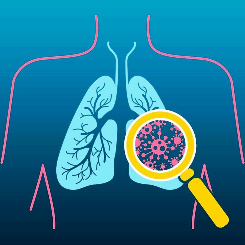 Sign And Symptoms Of Pneumonia In The Lungs