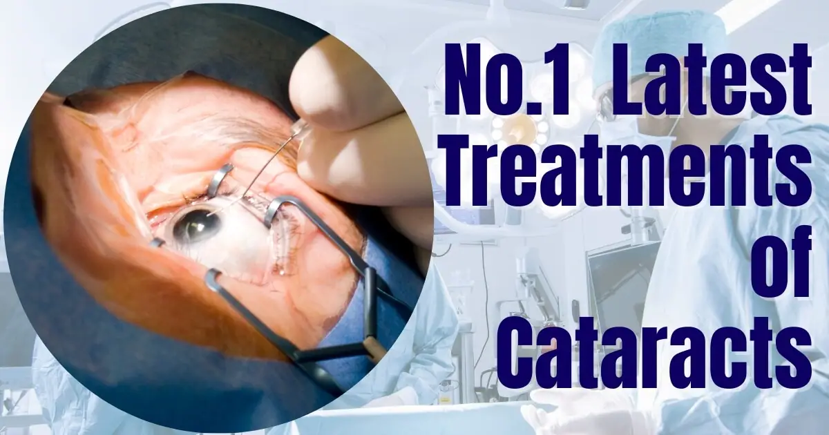 Latest No.1 Treatment of Cataracts: Exploring Options