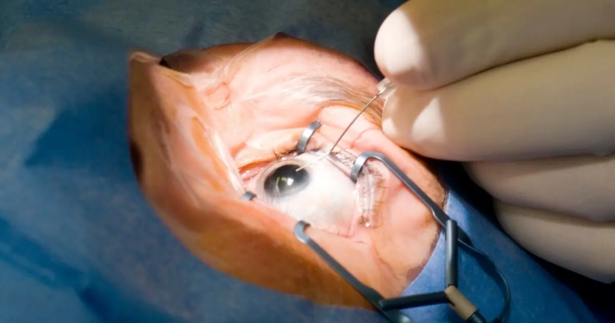 Treatment Of Cataracts